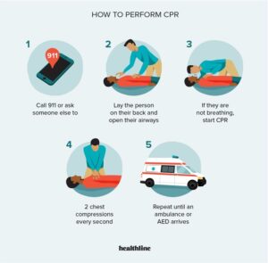 Cardiopulmonary resuscitation 